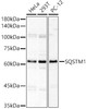 Western blot analysis of various lysates, using SQSTM1 Rabbit pAb (CAB22025) at 1:600 dilution. Secondary antibody: HRP Goat Anti-Rabbit IgG (H+L) at 1:10000 dilution. Lysates/proteins: 25ug per lane. Blocking buffer: 3% nonfat dry milk in TBST.