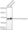 Western blot analysis of extracts of various cell lines, using Human Neurogranin antibody (CAB22030) at 1:400 dilution. Secondary antibody: HRP Goat Anti-Rabbit IgG (H+L) at 1:10000 dilution. Lysates/proteins: 25μg per lane. Blocking buffer: 3% nonfat dry milk in TBST.