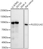 Western blot analysis of extracts of various cell lines, using PLOD2/LH2 antibody (CAB22040) at1:30000 dilution. Secondary antibody: HRP Goat Anti-Rabbit IgG (H+L) at 1:10000 dilution. Lysates/proteins: 25μg per lane. Blocking buffer: 3% nonfat dry milk in TBST.