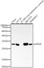 Western blot analysis of extracts of various cell lines, using MTAP antibody (CAB22045) at1:2000 dilution. Secondary antibody: HRP Goat Anti-Rabbit IgG (H+L) at 1:10000 dilution. Lysates/proteins: 25μg per lane. Blocking buffer: 3% nonfat dry milk in TBST.
