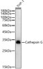 Western blot analysis of extracts of THP-1 cells, using Cathepsin G antibody (CAB22048) at1:1000 dilution. Secondary antibody: HRP Goat Anti-Rabbit IgG (H+L) at 1:10000 dilution. Lysates/proteins: 25μg per lane. Blocking buffer: 3% nonfat dry milk in TBST.
