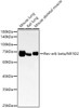 Western blot analysis of various lysates, using Rev-erb beta/NR1D2 Rabbit mAb (CAB22050) at1:2000 dilution. Secondary antibody: HRP Goat Anti-Rabbit IgG (H+L) at 1:10000 dilution. Lysates/proteins: 25μg per lane. Blocking buffer: 3% nonfat dry milk in TBST.