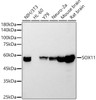 Western blot analysis of extracts of various cell lines, using SOX11 antibody (CAB22052) at1:20000 dilution. Secondary antibody: HRP Goat Anti-Rabbit IgG (H+L) at 1:10000 dilution. Lysates/proteins: 25μg per lane. Blocking buffer: 3% nonfat dry milk in TBST.