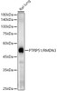 Western blot analysis of extracts of various cell lines, using PTPIP51/RMDN3 antibody (CAB22057) at1:2000 dilution. Secondary antibody: HRP Goat Anti-Rabbit IgG (H+L) at 1:10000 dilution. Lysates/proteins: 25μg per lane. Blocking buffer: 3% nonfat dry milk in TBST.