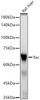 Western blot analysis of extracts of Rat liver, using Tec antibody (CAB22074) at 1:10000 dilution. Secondary antibody: HRP Goat Anti-Rabbit IgG (H+L) at 1:10000 dilution. Lysates/proteins: 25μg per lane. Blocking buffer: 3% nonfat dry milk in TBST.