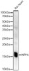 Western blot analysis of extracts of Rat heart, using NPPA antibody (CAB22075) at1:2000 dilution. Secondary antibody: HRP Goat Anti-Rabbit IgG (H+L) at 1:10000 dilution. Lysates/proteins: 25μg per lane. Blocking buffer: 3% nonfat dry milk in TBST.