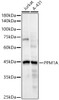 Western blot analysis of extracts of various cell lines, using PPM1A antibody (CAB22076) at1:20000 dilution. Secondary antibody: HRP Goat Anti-Rabbit IgG (H+L) at 1:10000 dilution. Lysates/proteins: 25μg per lane. Blocking buffer: 3% nonfat dry milk in TBST.