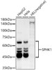 Western blot analysis of extracts of various cell lines, using SPHK1 antibody (CAB22093) at1:2000 dilution. Secondary antibody: HRP Goat Anti-Rabbit IgG (H+L) at 1:10000 dilution. Lysates/proteins: 25μg per lane. Blocking buffer: 3% nonfat dry milk in TBST.