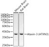 Western blot analysis of extracts from various lysates, using Ataxin-3 (ATXN3) antibody (CAB22094) at 1:2000 dilution. Secondary antibody: HRP Goat Anti-Rabbit IgG (H+L) at 1:10000 dilution. Lysates/proteins: 25ug per lane. Blocking buffer: 3% nonfat dry milk in TBST.