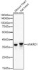 Western blot analysis of extracts of various cell lines, using ANKRD1 antibody (CAB22095) at1:2000 dilution. Secondary antibody: HRP Goat Anti-Rabbit IgG (H+L) at 1:10000 dilution. Lysates/proteins: 25μg per lane. Blocking buffer: 3% nonfat dry milk in TBST.