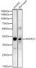 Western blot analysis of extracts of various cell lines, using ANKRD1 antibody (CAB22096) at1:2000 dilution. Secondary antibody: HRP Goat Anti-Rabbit IgG (H+L) at 1:10000 dilution. Lysates/proteins: 25μg per lane. Blocking buffer: 3% nonfat dry milk in TBST.