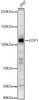 Western blot analysis of 293T, using COP1 Rabbit pAb (CAB22106) at 1:600 dilution. Secondary antibody: HRP Goat Anti-Rabbit IgG (H+L) at 1:10000 dilution. Lysates/proteins: 25ug per lane. Blocking buffer: 3% nonfat dry milk in TBST.