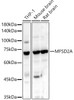 Western blot analysis of various lysates, using MFSD2A antibody (CAB22116) at 1:1000 dilution. Secondary antibody: HRP Goat Anti-Rabbit IgG (H+L) at 1:10000 dilution. Lysates/proteins: 25μg per lane. Blocking buffer: 3% nonfat dry milk in TBST.