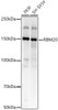 Western blot analysis of various lysates, using RBM20 Rabbit pAb (CAB22117) at 1:400 dilution. Secondary antibody: HRP Goat Anti-Rabbit IgG (H+L) at 1:10000 dilution. Lysates/proteins: 25ug per lane. Blocking buffer: 3% nonfat dry milk in TBST.