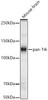 Western blot analysis of Mouse brain, using pan-Trk Rabbit pAb (CAB22121) at 1:400 dilution. Secondary antibody: HRP Goat Anti-Rabbit IgG (H+L) at 1:10000 dilution. Lysates/proteins: 25ug per lane. Blocking buffer: 3% nonfat dry milk in TBST.