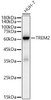 Western blot analysis of extracts of HUH-7, using TREM2 antibody (CAB22134) at 1:10000 dilution. Secondary antibody: HRP Goat Anti-Rabbit IgG (H+L) at 1:10000 dilution. Lysates/proteins: 25μg per lane. Blocking buffer: 3% nonfat dry milk in TBST.