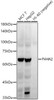 Western blot analysis of various lysates, using P4HA2 antibody (CAB22150) at1:20000 dilution. Secondary antibody: HRP Goat Anti-Rabbit IgG (H+L) at 1:10000 dilution. Lysates/proteins: 25μg per lane. Blocking buffer: 3% nonfat dry milk in TBST.