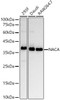 Western blot analysis of various lysates, using NACA antibody (CAB22165) at1:20000 dilution. Secondary antibody: HRP Goat Anti-Rabbit IgG (H+L) at 1:10000 dilution. Lysates/proteins: 25μg per lane. Blocking buffer: 3% nonfat dry milk in TBST.