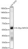 Western blot analysis of SH-SY5Y, using N-Myc/MYCN antibody (CAB22174) at1:2000 dilution. Secondary antibody: HRP Goat Anti-Rabbit IgG (H+L) at 1:10000 dilution. Lysates/proteins: 25μg per lane. Blocking buffer: 3% nonfat dry milk in TBST.