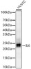 Western blot analysis of HUVEC, using IL6 antibody (CAB22222) at 1:1000 dilution. Secondary antibody: HRP Goat Anti-Rabbit IgG (H+L) at 1:10000 dilution. Lysates/proteins: 25μg per lane. Blocking buffer: 3% nonfat dry milk in TBST.