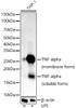 Western blot analysis of various lysates, using TNF-α antibody (CAB22227) at1:1000 dilution. THP-1 cells were treated by LPS (1 μg/ml) at 37℃ for 8 hours. Secondary antibody: HRP Goat Anti-Rabbit IgG (H+L) at 1:10000 dilution. Lysates/proteins: 25μg per lane. Blocking buffer: 3% nonfat dry milk in TBST.