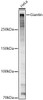 Western blot analysis of HeLa, using Giantin antibody (CAB22233) at 1:1000 dilution. Secondary antibody: HRP Goat Anti-Rabbit IgG (H+L) at 1:10000 dilution. Lysates/proteins: 25μg per lane. Blocking buffer: 3% nonfat dry milk in TBST.