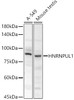 Western blot analysis of various lysates, using HNRNPUL1 antibody (CAB22236) at 1:500 dilution. Secondary antibody: HRP Goat Anti-Rabbit IgG (H+L) at 1:10000 dilution. Lysates/proteins: 25μg per lane. Blocking buffer: 3% nonfat dry milk in TBST.