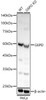 Western blot analysis of extracts from normal (control) and G6PD knockdown (KD) HeLa cells, using G6PD antibody (CAB22242) at 1:500 dilution. Secondary antibody: HRP Goat Anti-Rabbit IgG (H+L) at 1:10000 dilution. Lysates/proteins: 25μg per lane. Blocking buffer: 3% nonfat dry milk in TBST.