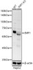Western blot analysis of extracts from normal (control) and knockdown (KD) HepG2 cells, using ZEB1 antibody (CAB22246) at 1:1000 dilution. Secondary antibody: HRP Goat Anti-Rabbit IgG (H+L) at 1:10000 dilution. Lysates/proteins: 25μg per lane. Blocking buffer: 3% nonfat dry milk in TBST.