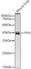 Western blot analysis of Mouse lung, using NKX2-1 antibody (CAB22247) at1:2000 dilution. Secondary antibody: HRP Goat Anti-Rabbit IgG (H+L) at 1:10000 dilution. Lysates/proteins: 25μg per lane. Blocking buffer: 3% nonfat dry milk in TBST.