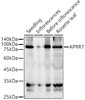 Western blot analysis of extracts of various tissues from Arabidopsis thaliana, using APRR7 antibody (CAB22255) at 1:900 dilution. Secondary antibody: HRP Goat Anti-Rabbit IgG (H+L) at 1:10000 dilution. Lysates/proteins: 25μg per lane. Blocking buffer: 3% nonfat dry milk in TBST.