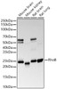 Western blot analysis of various lysates, using RhoB antibody (CAB22258) at1:20000 dilution. Secondary antibody: HRP Goat Anti-Rabbit IgG (H+L) at 1:10000 dilution. Lysates/proteins: 25μg per lane. Blocking buffer: 3% nonfat dry milk in TBST.