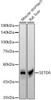 Western blot analysis of various lysates, using SETD6 antibody (CAB22262) at 1:2000 dilution. Secondary antibody: HRP Goat Anti-Rabbit IgG (H+L) at 1:10000 dilution. Lysates/proteins: 25μg per lane. Blocking buffer: 3% nonfat dry milk in TBST.