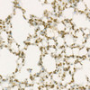 Immunohistochemistry analysis of paraffin-embedded mouse lung using WEE1 Rabbit mAb (CAB22275) at dilution of 1:100(40x lens). Perform high pressure antigen retrieval with 10 mM citrate buffer pH 6. 0 before commencing with IHC staining protocol.