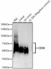 Western blot analysis of various lysates, using CD58 antibody (CAB22276) at1:20000 dilution. Secondary antibody: HRP Goat Anti-Rabbit IgG (H+L) at 1:10000 dilution. Lysates/proteins: 25μg per lane. Blocking buffer: 3% nonfat dry milk in TBST.