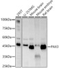 Western blot analysis of various lysates, using PAX3 antibody (CAB22293) at 1:600 dilution. Secondary antibody: HRP Goat Anti-Rabbit IgG (H+L) at 1:10000 dilution. Lysates/proteins: 25μg per lane. Blocking buffer: 3% nonfat dry milk in TBST.