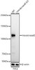 Western blot analysis of extracts from normal (control) and HexokinaseII knockout (KO) HeLa(KO) cells, using HexokinaseII antibody (CAB22319) at 1:1000 dilution. Secondary antibody: HRP Goat Anti-Rabbit IgG (H+L) at 1:10000 dilution. Lysates/proteins: 25μg per lane. Blocking buffer: 3% nonfat dry milk in TBST.