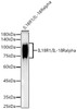 Western blot analysis of various lysates, using IL18R1/IL-18Ralpha antibody (CAB22369) at 1:1000 dilution. Secondary antibody: HRP Goat Anti-Rabbit IgG (H+L) at 1:10000 dilution. Lysates/proteins: 25μg per lane. Blocking buffer: 3% nonfat dry milk in TBST.
