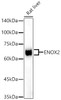 Western blot analysis of Rat liver, using ENOX2 antibody (CAB22403) at 1:2000 dilution. Secondary antibody: HRP Goat Anti-Rabbit IgG (H+L) at 1:10000 dilution. Lysates/proteins: 25μg per lane. Blocking buffer: 3% nonfat dry milk in TBST.