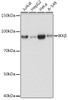 Western blot analysis of extracts of various cell lines, using IKKβ antibody (CAB22425) at 1:1000 dilution. Secondary antibody: HRP Goat Anti-Rabbit IgG (H+L) at 1:10000 dilution. Lysates/proteins: 25μg per lane. Blocking buffer: 3% nonfat dry milk in TBST.