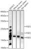 Western blot analysis of various lysates, using FGF2 antibody (CAB22448) at 1:1000 dilution. Secondary antibody: HRP Goat Anti-Rabbit IgG (H+L) at 1:10000 dilution. Lysates/proteins: 25μg per lane. Blocking buffer: 3% nonfat dry milk in TBST.