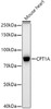 Western blot analysis of extracts of Mouse heart, using CPT1A antibody (CAB22450) at1:1000 dilution. Secondary antibody: HRP Goat Anti-Rabbit IgG (H+L) at1:10000 dilution. Lysates/proteins: 25μg per lane. Blocking buffer: 3% nonfat dry milk in TBST.
