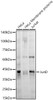 Western blot analysis of various lysates, using JunD antibody (CAB22466) at1:2000 dilution. Secondary antibody: HRP Goat Anti-Rabbit IgG (H+L) at 1:10000 dilution. Lysates/proteins: 25μg per lane. Blocking buffer: 3% nonfat dry milk in TBST.