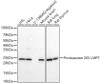 Western blot analysis of various lysates, using Proteasome 20S LMP7 antibody (CAB22542) at 1:600 dilution. Secondary antibody: HRP Goat Anti-Rabbit IgG (H+L) at 1:10000 dilution. Lysates/proteins: 25μg per lane. Blocking buffer: 3% nonfat dry milk in TBST.