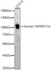 Western blot analysis of C2C12, using Human TNFRSF11A antibody (CAB22547) at 1:500 dilution. Secondary antibody: HRP Goat Anti-Rabbit IgG (H+L) at 1:10000 dilution. Lysates/proteins: 25μg per lane. Blocking buffer: 3% nonfat dry milk in TBST.