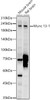 Western blot analysis of various lysates, using Munc 13-1 antibody (CAB22550) at 1:2000 dilution. Secondary antibody: HRP Goat Anti-Rabbit IgG (H+L) at 1:10000 dilution. Lysates/proteins: 25μg per lane. Blocking buffer: 3% nonfat dry milk in TBST.