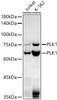 Western blot analysis of various lysates, using PLK1 antibody (CAB22595) at 1:1000 dilution. Secondary antibody: HRP Goat Anti-Rabbit IgG (H+L) at 1:10000 dilution. Lysates/proteins: 25μg per lane. Blocking buffer: 3% nonfat dry milk in TBST.