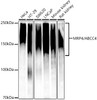 Western blot analysis of various lysates, using MRP4/ABCC4 antibody (CAB22601) at 1:1000 dilution. Secondary antibody: HRP Goat Anti-Rabbit IgG (H+L) at 1:10000 dilution. Lysates/proteins: 25μg per lane. Blocking buffer: 3% nonfat dry milk in TBST.