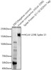 Western blot analysis of various lysates, using HCoV-229E Spike S1 antibody (CAB22605) at 1:800 dilution. Secondary antibody: HRP Goat Anti-Rabbit IgG (H+L) at 1:10000 dilution. Lysates/proteins: 25μg per lane. Blocking buffer: 3% nonfat dry milk in TBST.