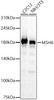 Western blot analysis of various lysates, using MSH6 antibody (CAB22652) at 1:3000 dilution. Secondary antibody: HRP Goat Anti-Rabbit IgG (H+L) at 1:10000 dilution. Lysates/proteins: 25μg per lane. Blocking buffer: 3% nonfat dry milk in TBST.